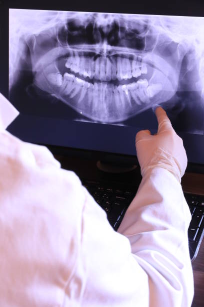 Best Emergency Gum Treatment in Exeter, CA