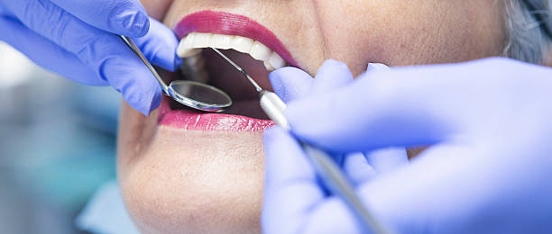 Best Emergency Tooth Extraction in Exeter, CA